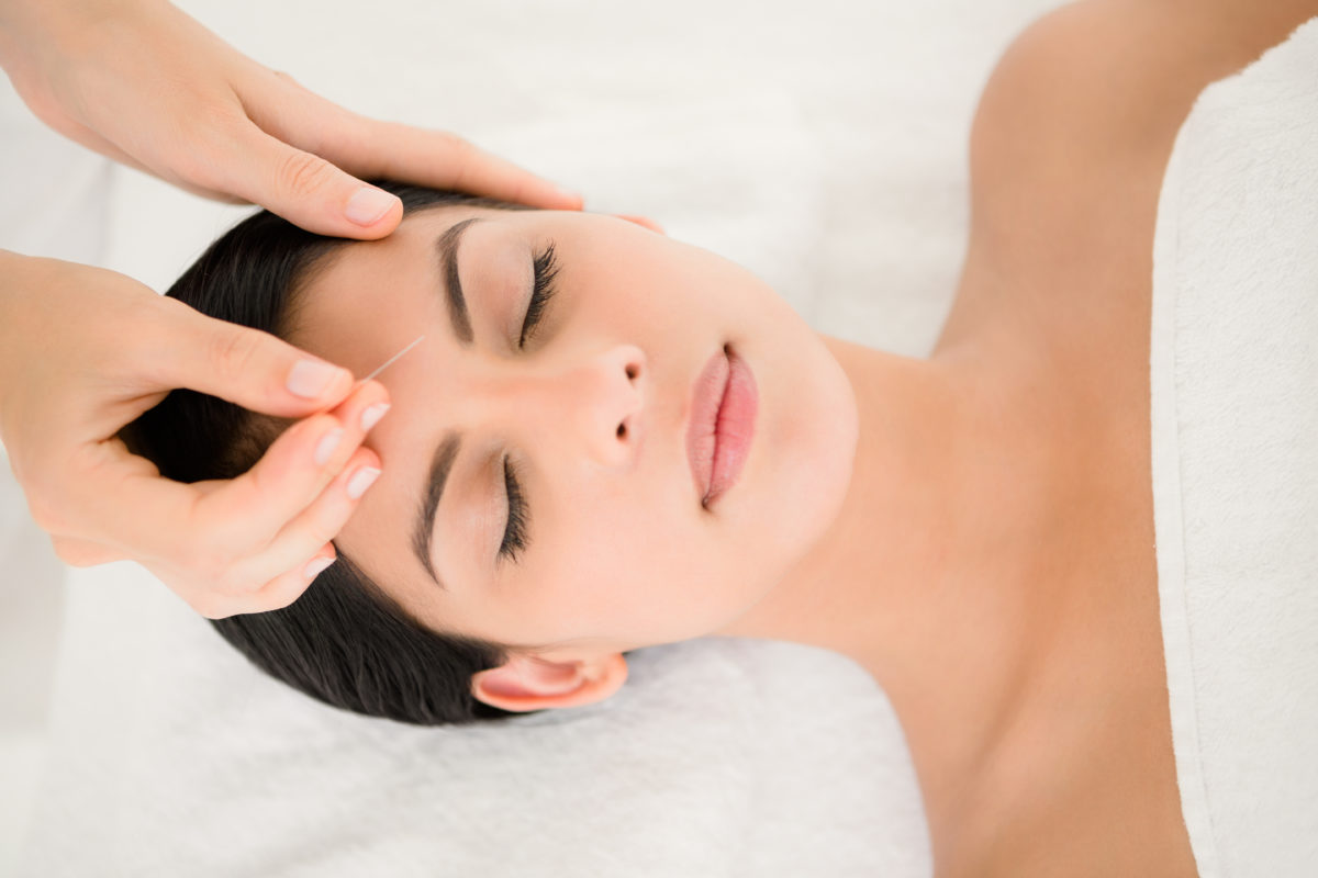 Does Acupuncture Really Help Stress? Living Safer Magazine